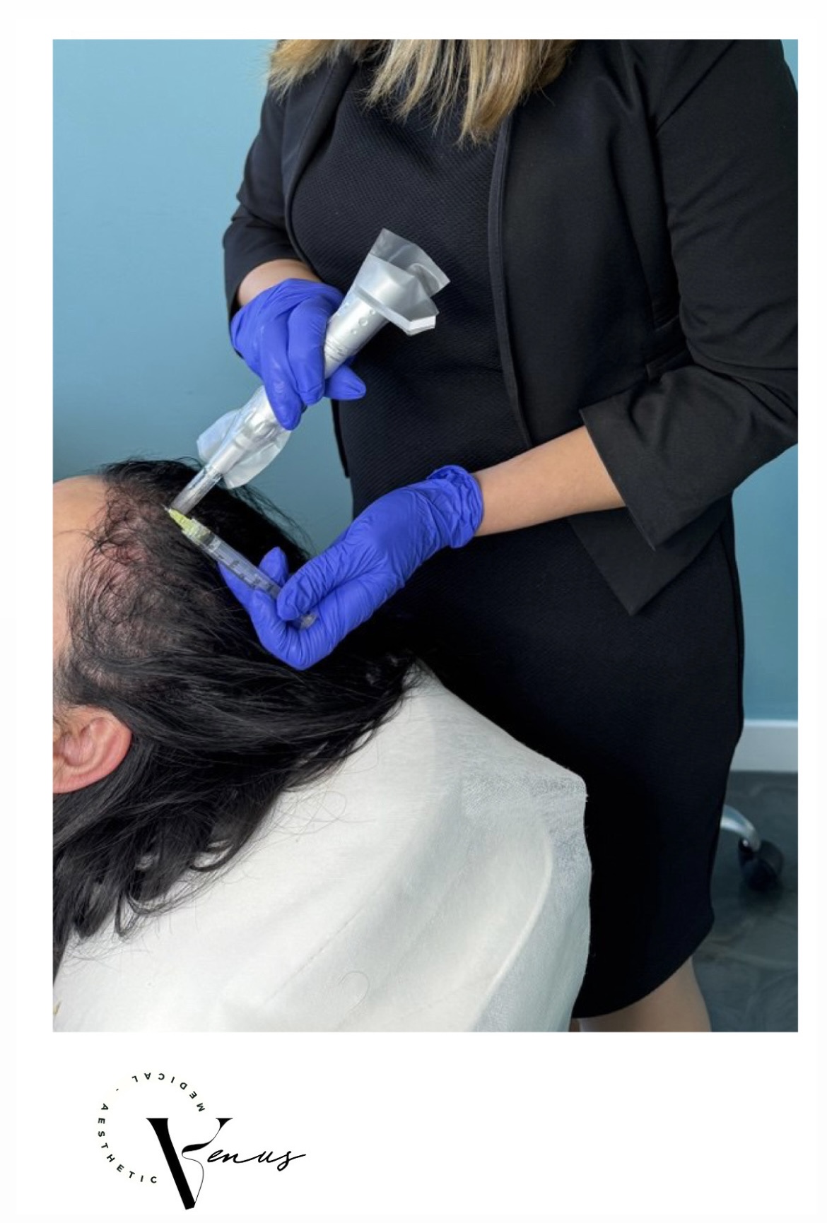 Before and after aesthetic treatment result 12 at Venus Clinic Laval