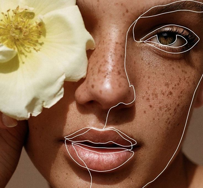 Venus Medical Aesthetic clinic treatments in Laval