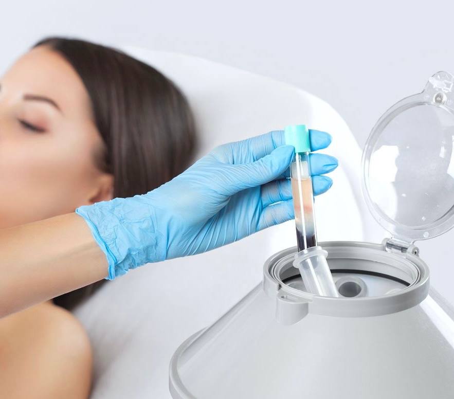 PRP (Platelet-Rich Plasma)